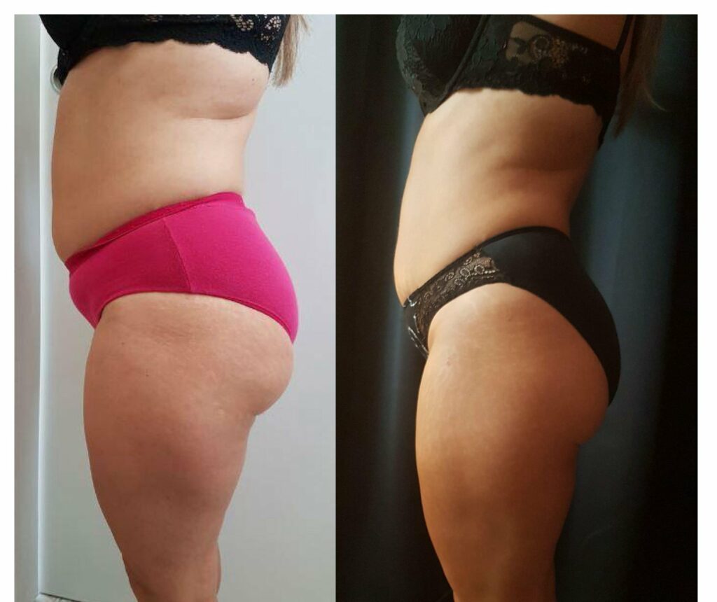 65654274_1258529577648433_8913448781618348032_n