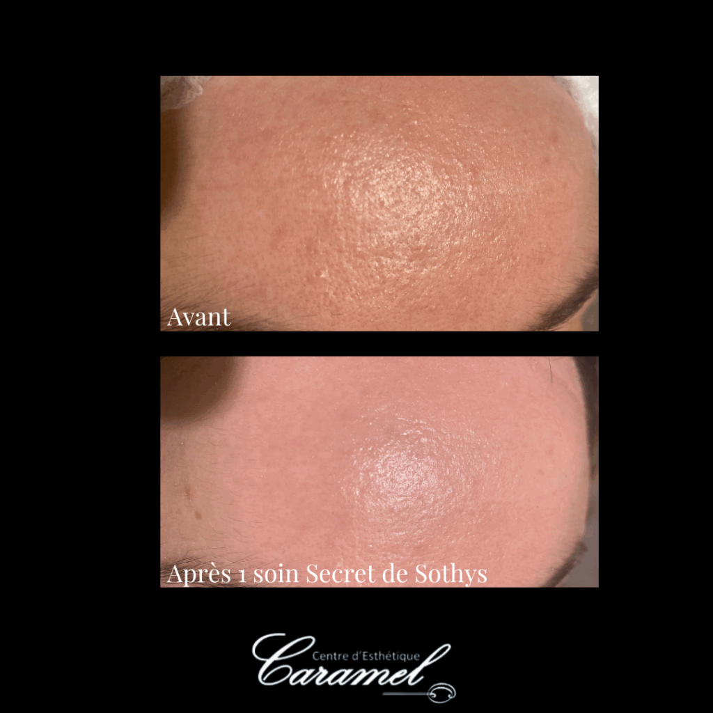 Avant après soin visage manuel secret de Sothys 1