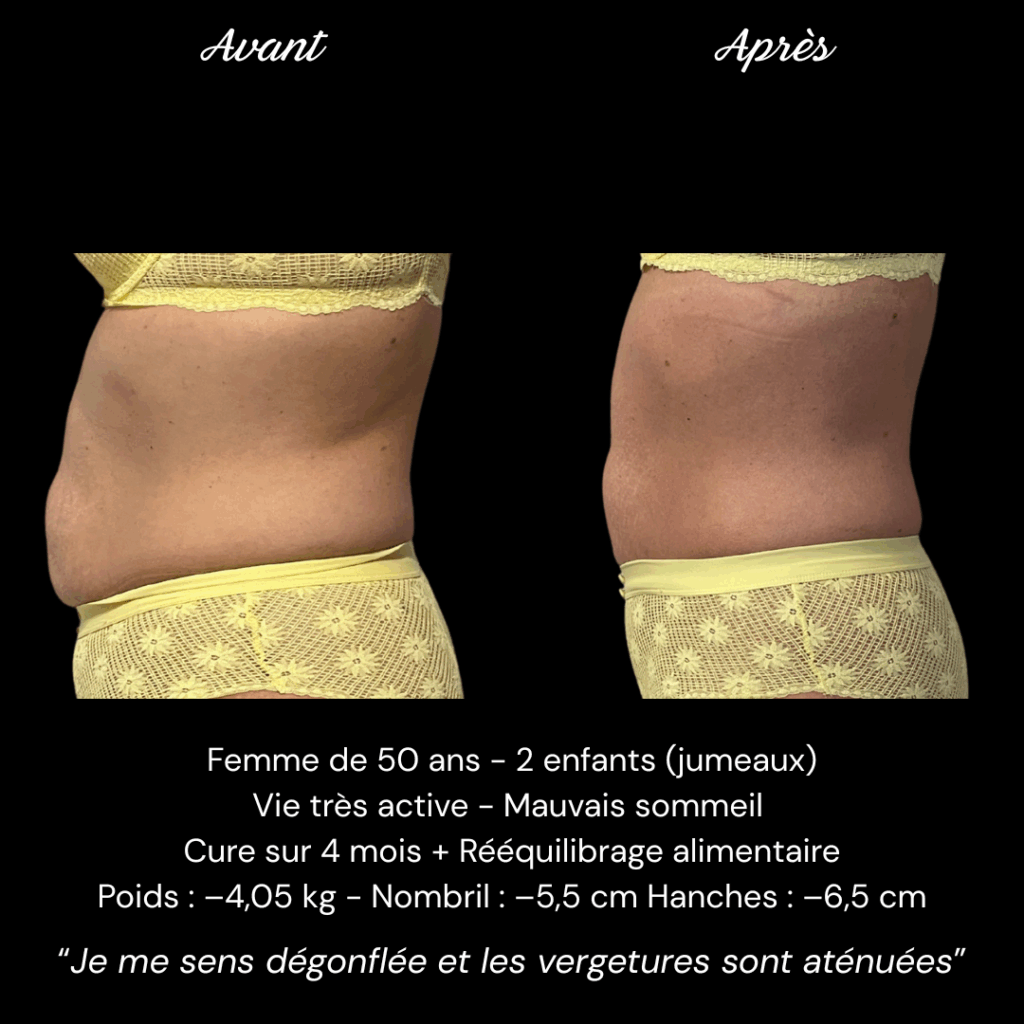 Avant Après Mme DESVALS (1)