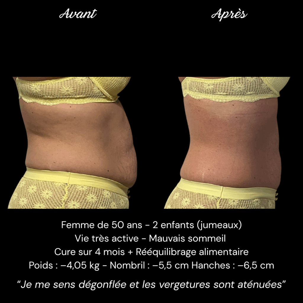 Avant Après Mme DESVALS (2)