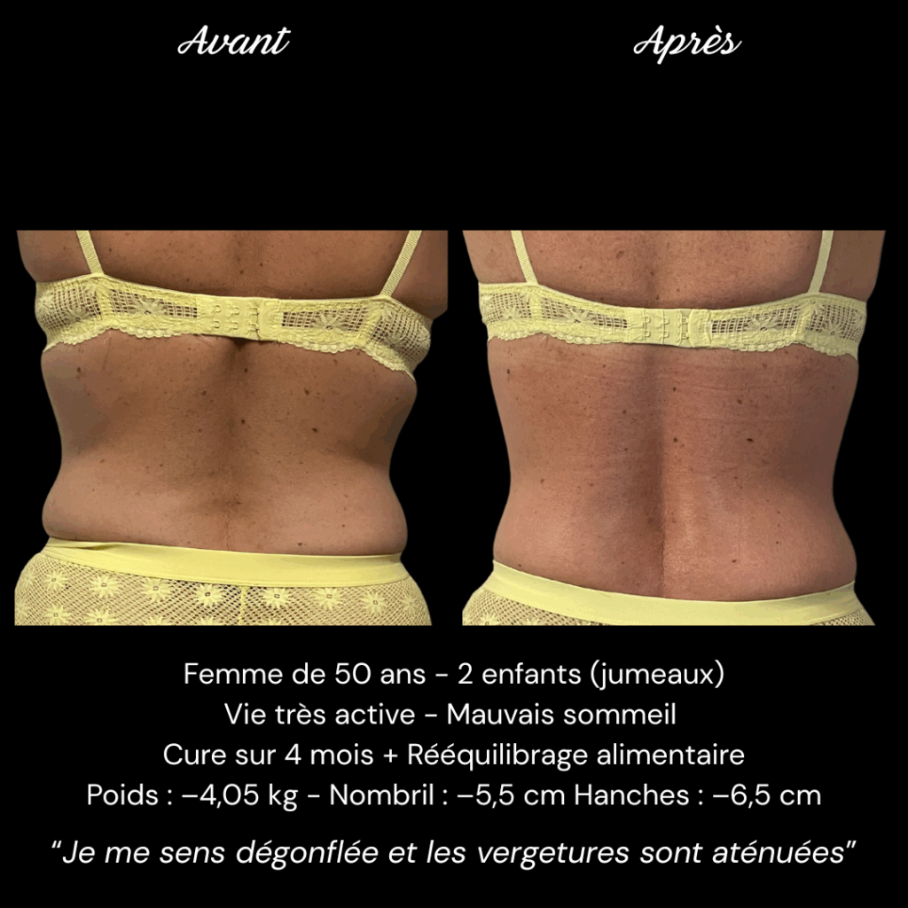 Avant Après Mme DESVALS (3)