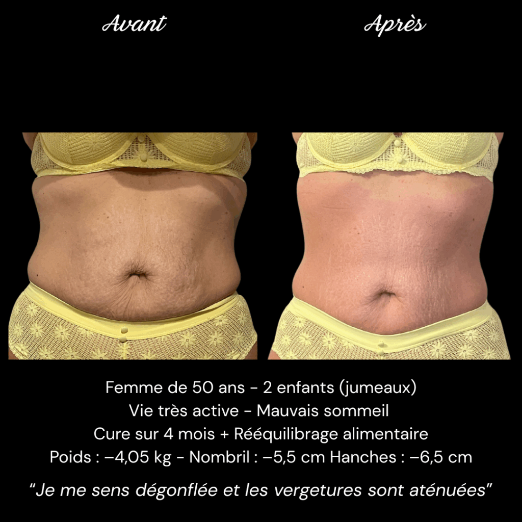 Avant Après Mme DESVALS (5)