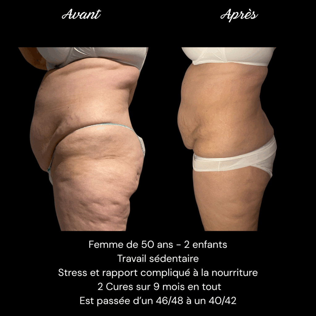 Cure-minceur-accompagnement-IN