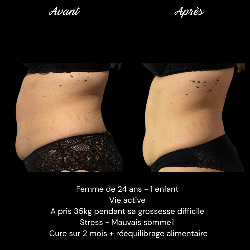 Cure-ventre-minceur-cellulite-e