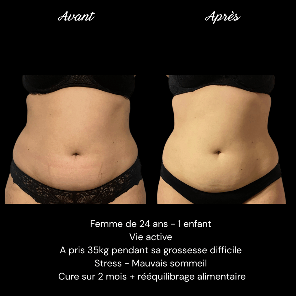 Cure-ventre-minceur-cellulite-e1