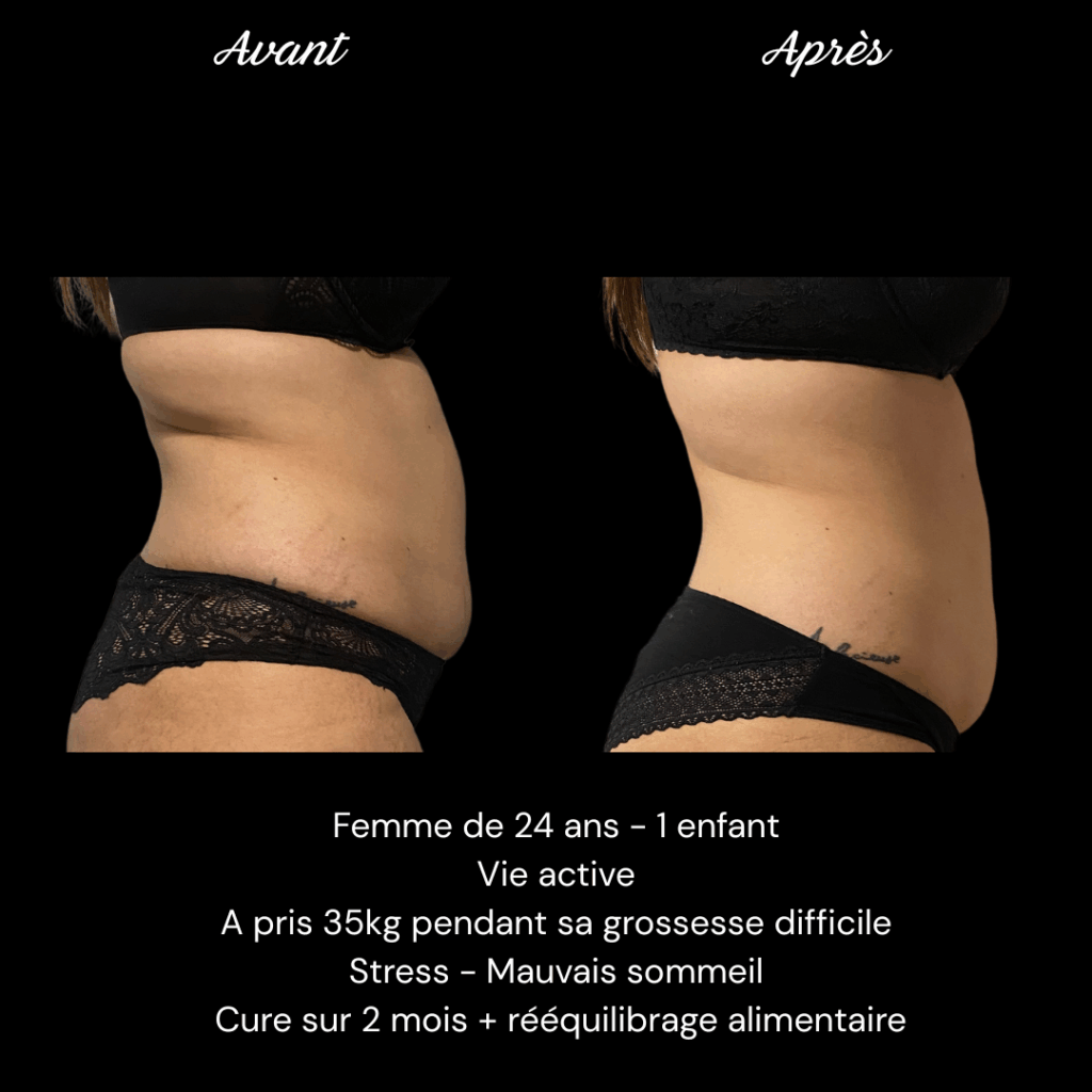 Cure-ventre-minceur-cellulite-e2