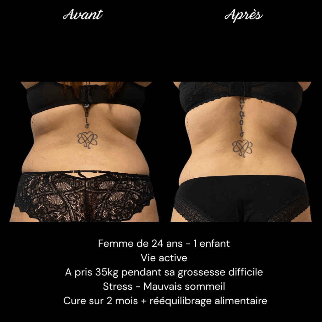 Cure-ventre-minceur-cellulite-e3