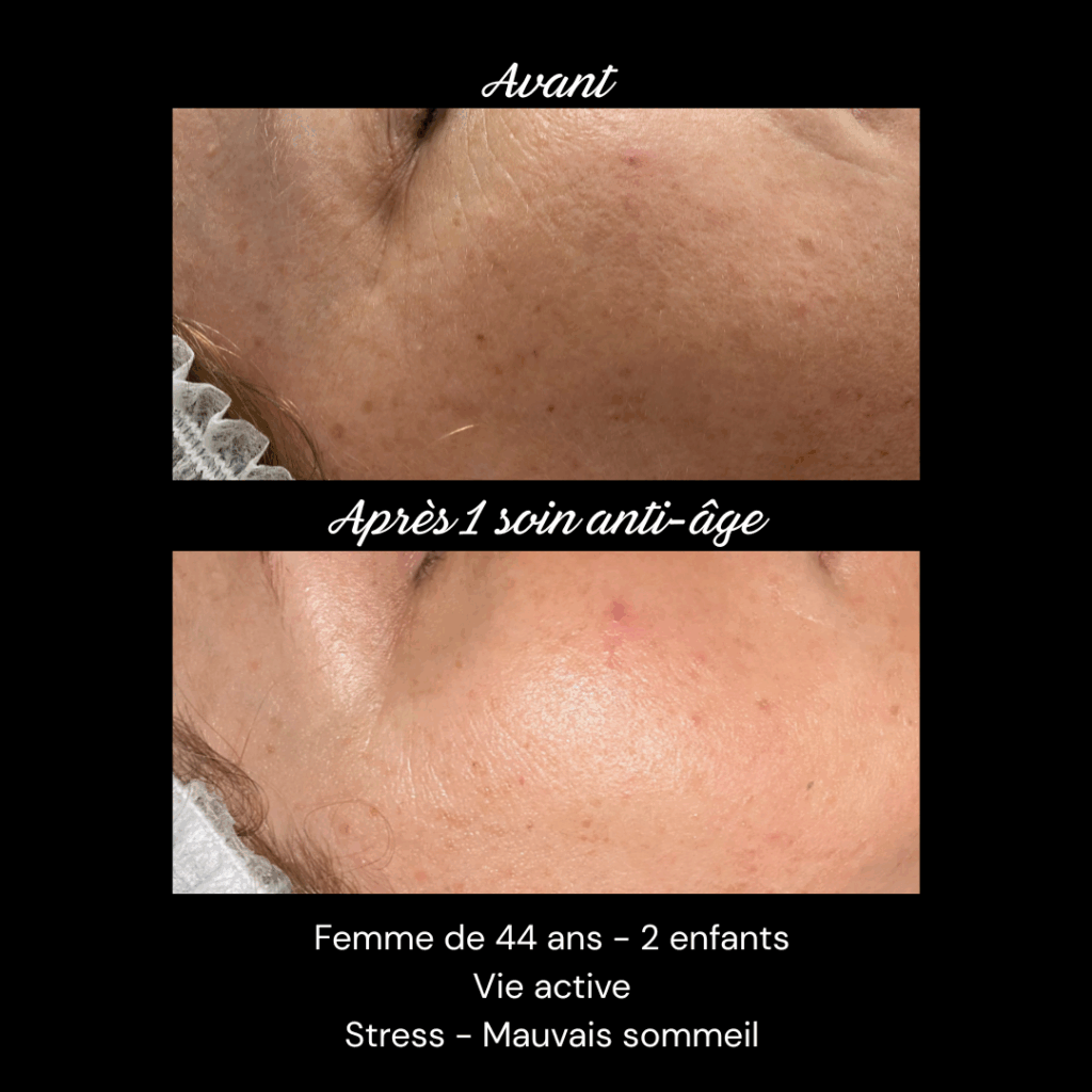 anti-age-soin-visage-rides-fermete