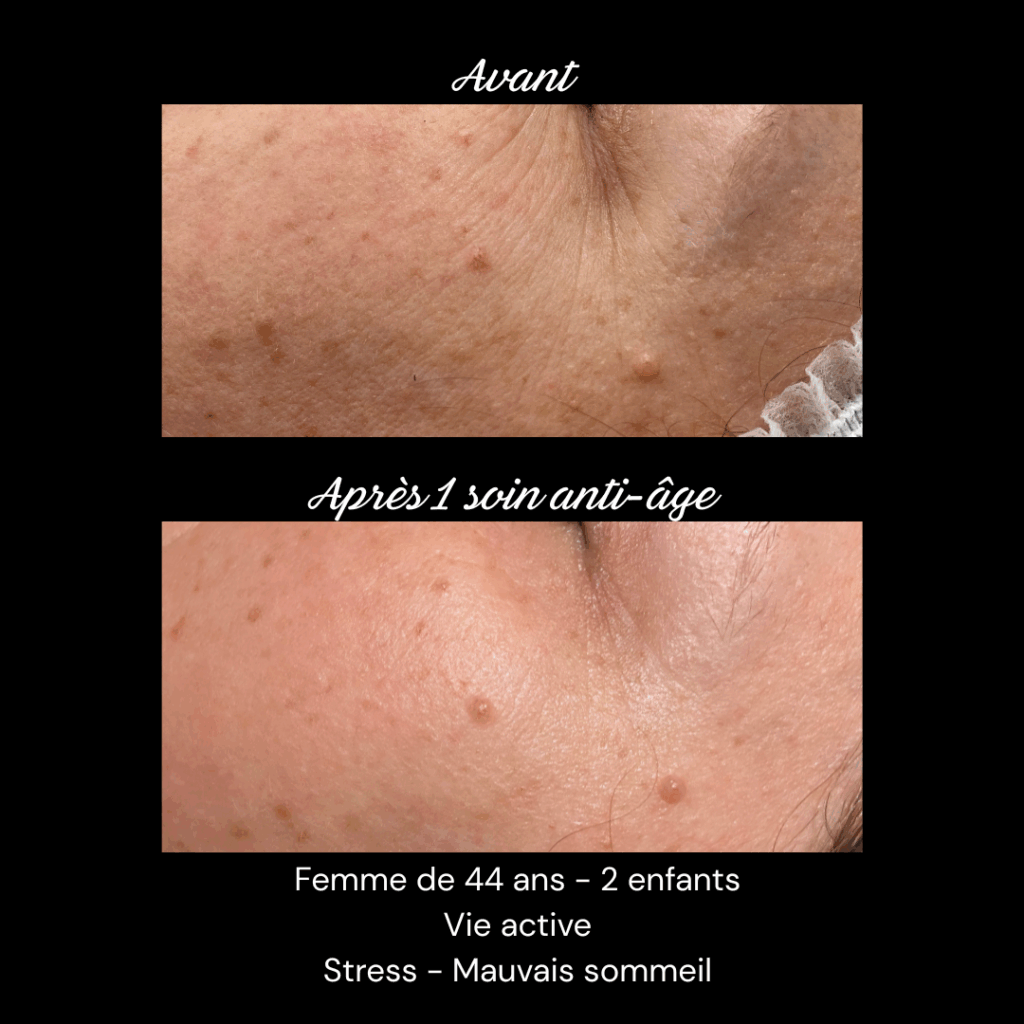 anti-age-soin-visage-rides-fermete1