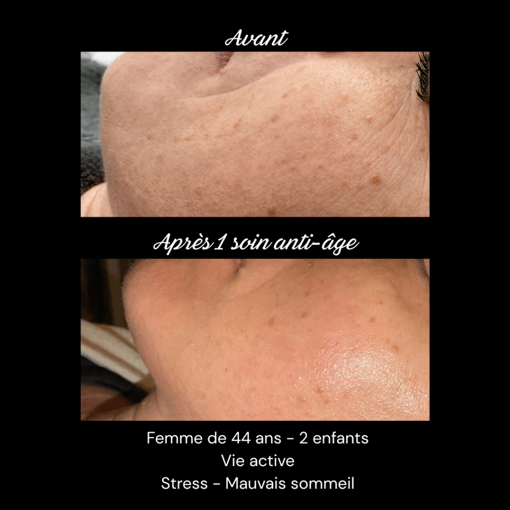 anti-age-soin-visage-rides-fermete2