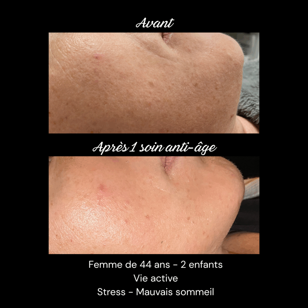 anti-age-soin-visage-rides-fermete3