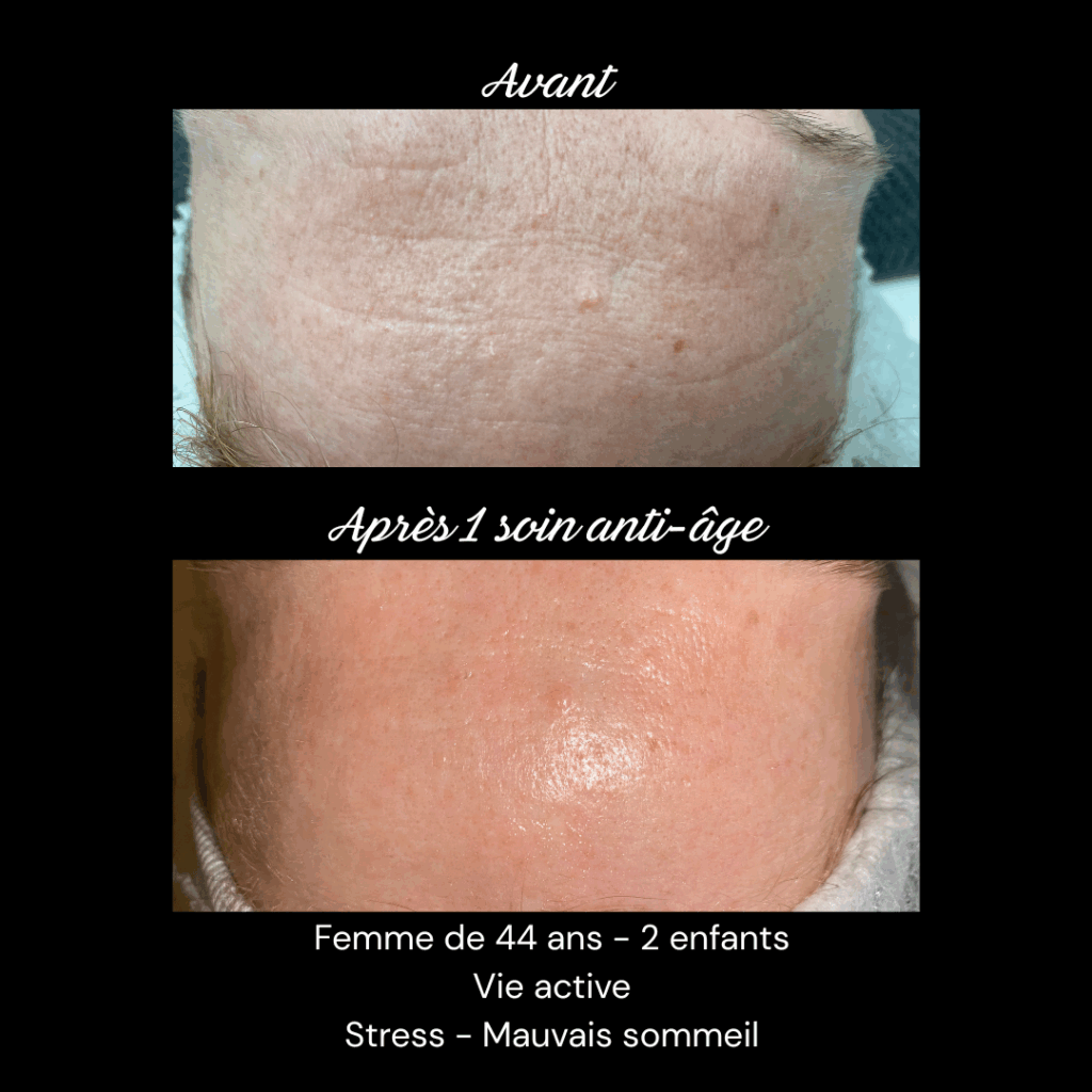 anti-age-soin-visage-rides-fermete4