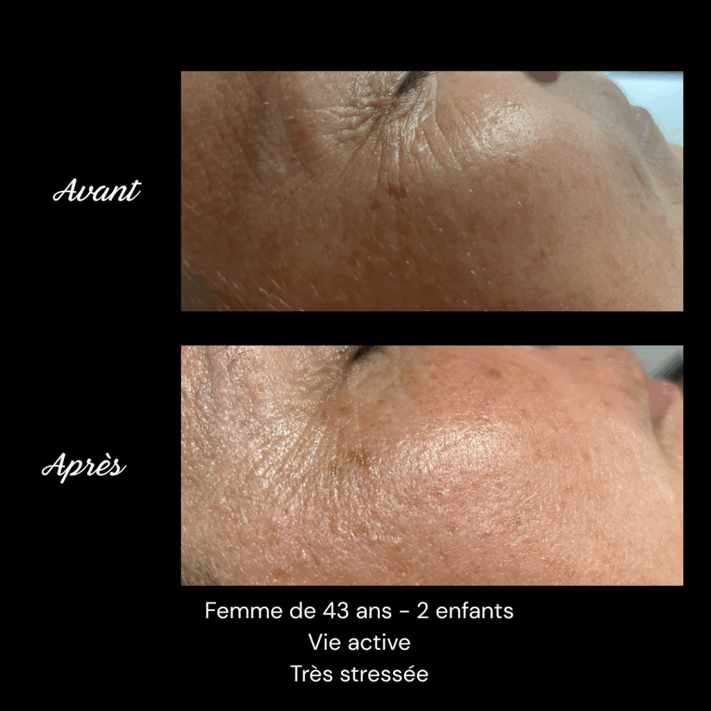 cure-anti-age-soin-visage-rides-fermete