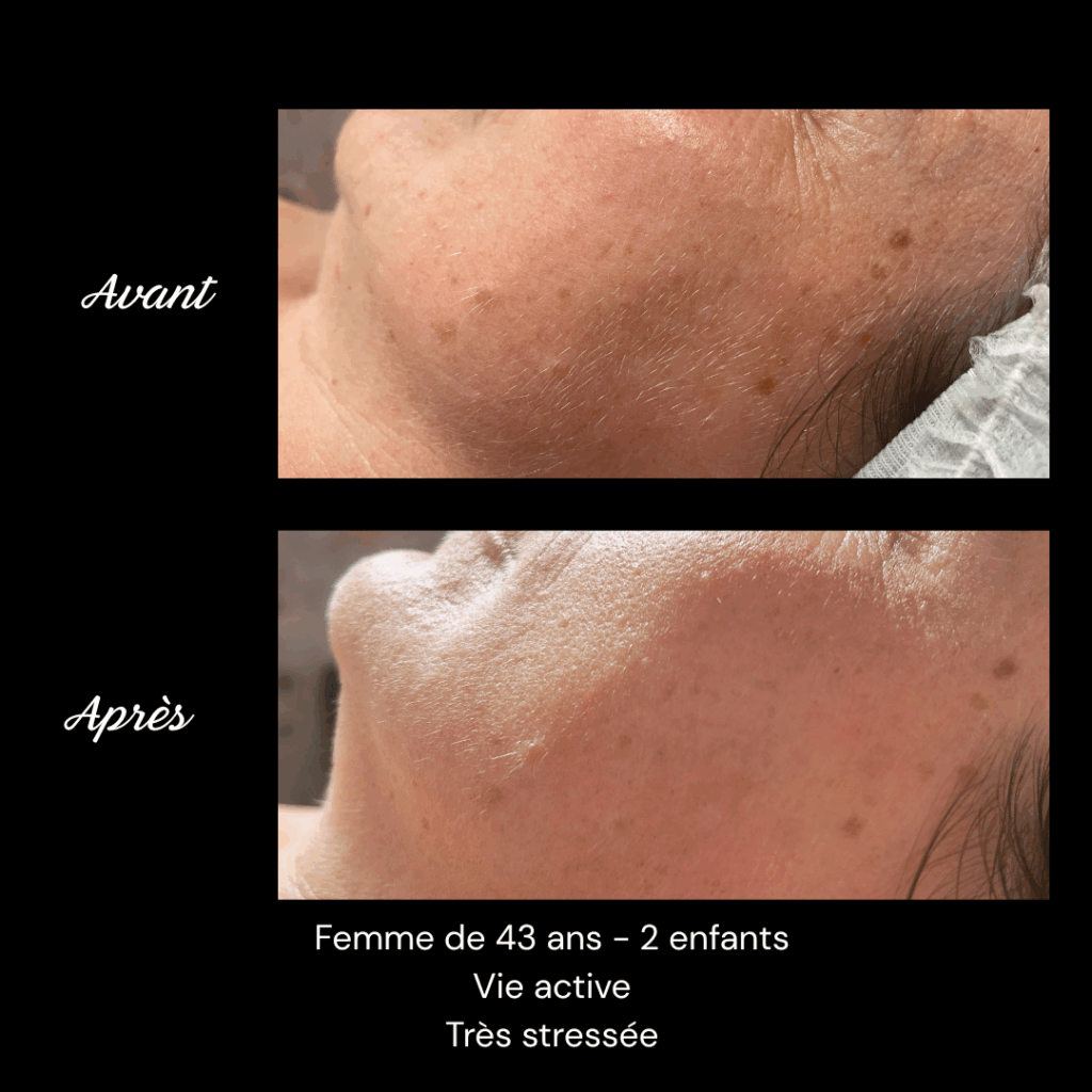 cure-anti-age-soin-visage-rides-fermete1
