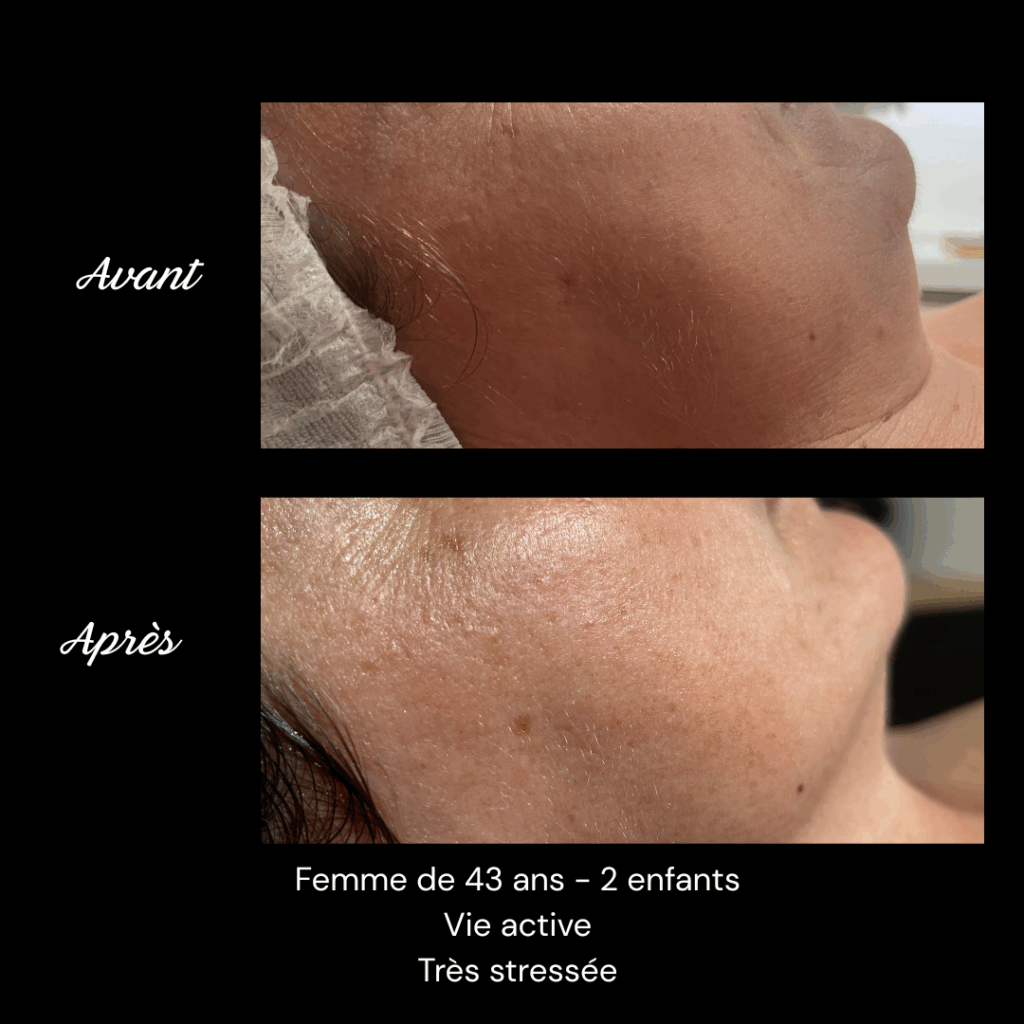 cure-anti-age-soin-visage-rides-fermete2