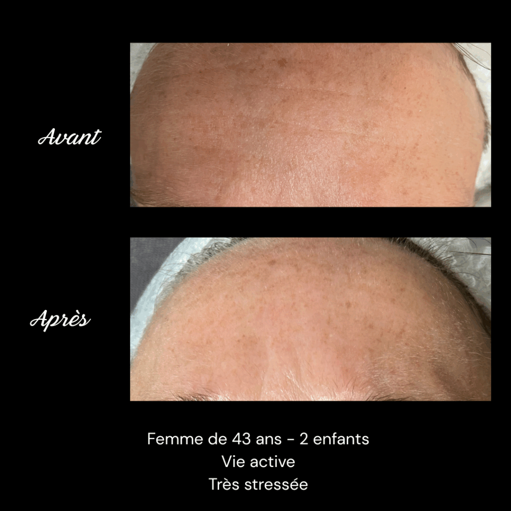 cure-anti-age-soin-visage-rides-fermete3
