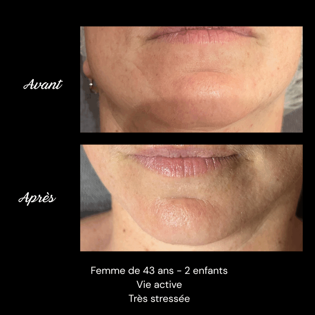 cure-anti-age-soin-visage-rides-fermete4