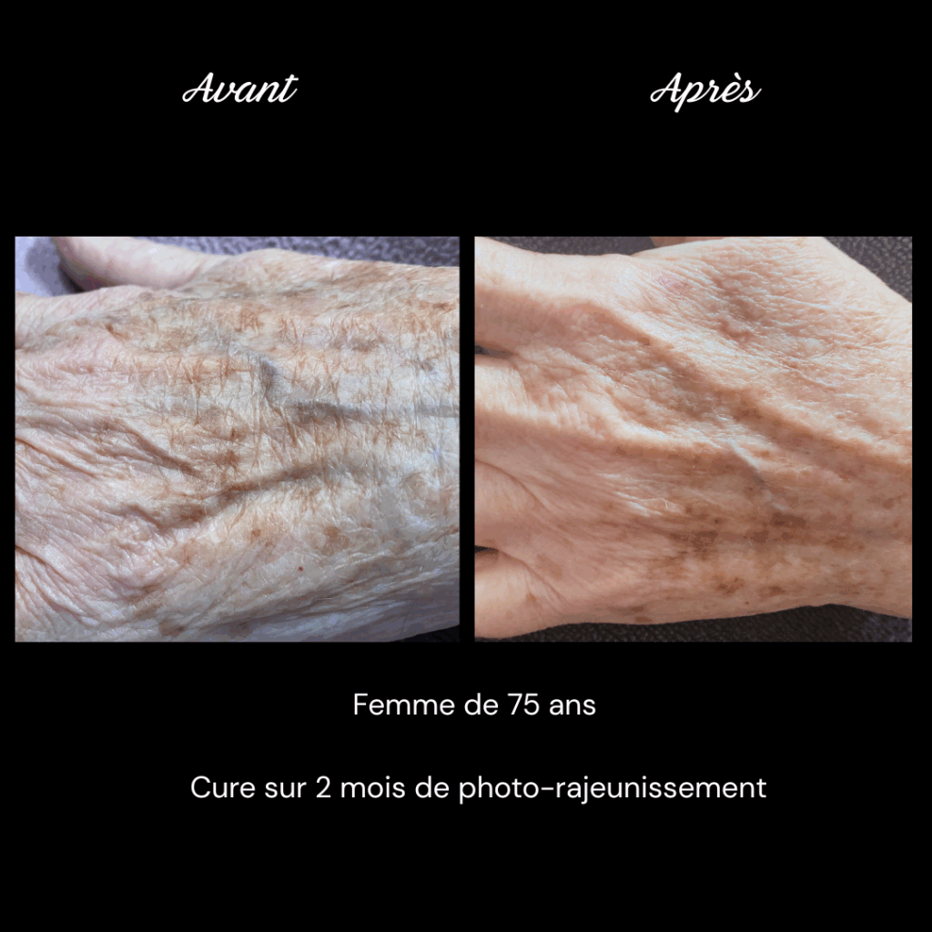 photo-rajeunissement-anti-age-soin-visage1
